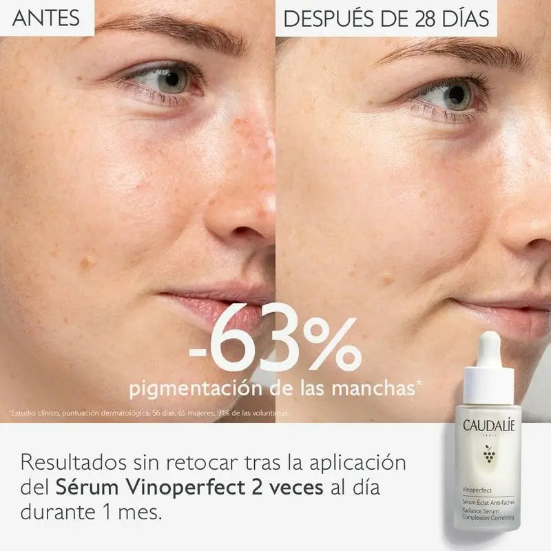 Caudalie Vinoperfect -seerumi, joka antaa hehkua ja torjuu pigmenttimuutoksia, 30 ml