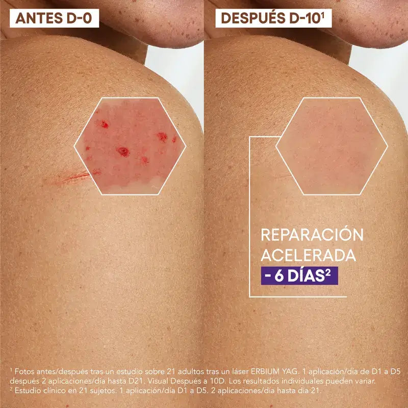 A-Derma Epitheliale AH Ultra -rauhoittava, arpia ehkäisevä korjaava voide 40 ml