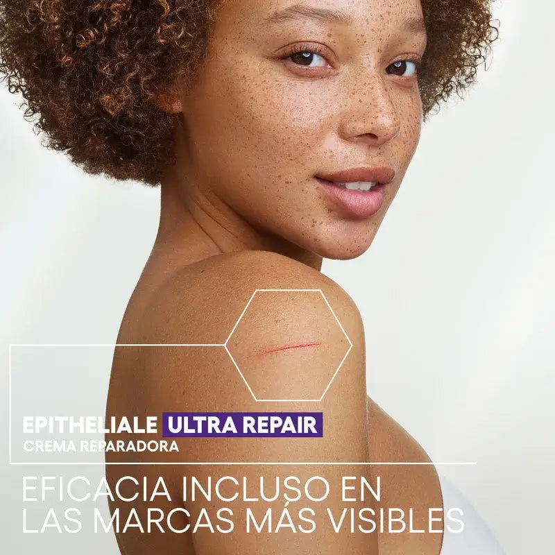 A-Derma Epitheliale AH Ultra -rauhoittava, arpia ehkäisevä korjaava voide 40 ml