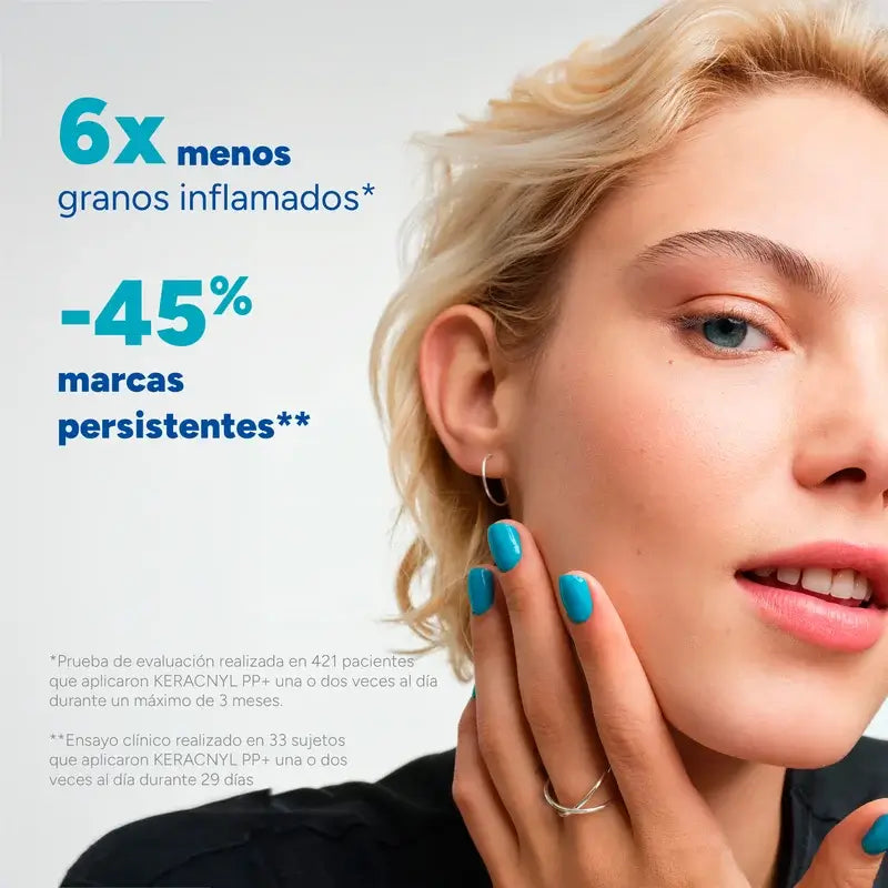 Ducray Keracnyl PP+ aknea ja ihon epäpuhtauksia hoitava voide 30 ml