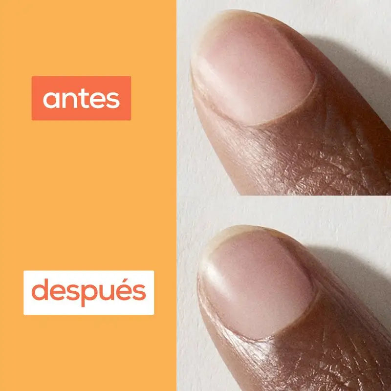 Essie On A Roll Apricot -kosteuttava öljy kynsille ja kynsinauhoille.