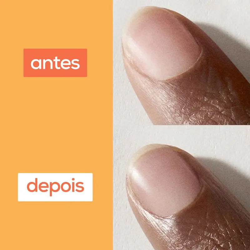 Essie On A Roll Apricot -kosteuttava öljy kynsille ja kynsinauhoille.