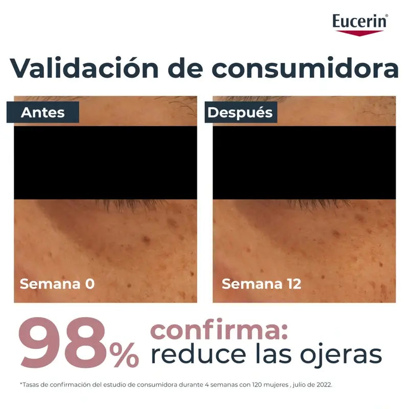 Eucerin Anti-Pigment -silmänympärysvoide pigmenttimuutosten ja tummien silmänalusten hoitoon, 15 ml