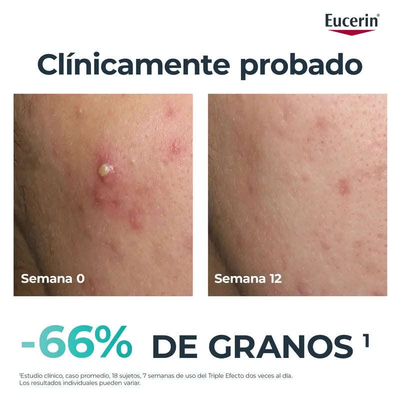 Eucerin Dermopure Oil Control kolminkertaisvaikutteinen seerumi, 40 ml
