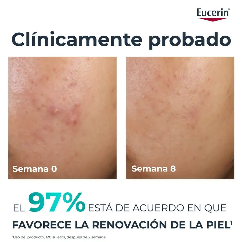 Eucerin Dermopure Peeling 10 % hydroksihappoja, 40 ml