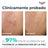 Eucerin Dermopure Peeling 10 % hydroksihappoja, 40 ml