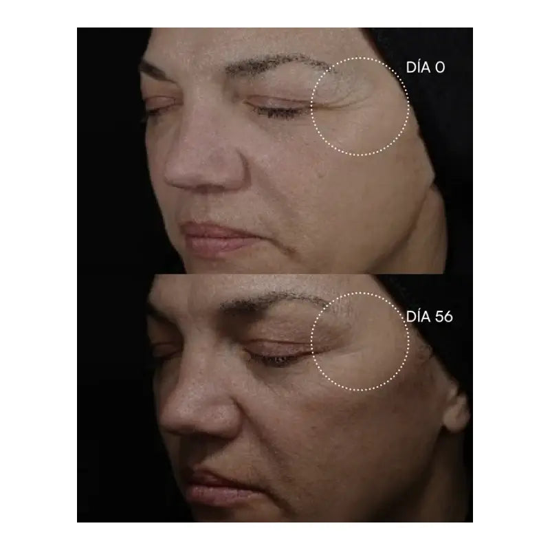 Gema Herrerías 20 Kemiallinen kuorinta 20 lappua 23 ml
