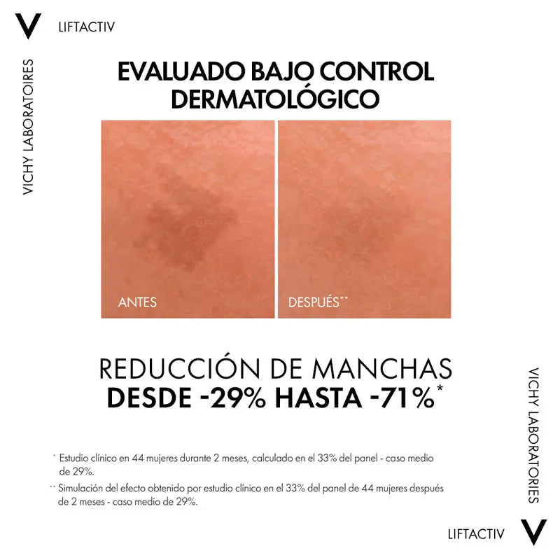 Vichy Liftactiv Specialist B3-seerumi pigmenttimuutosten hoitoon