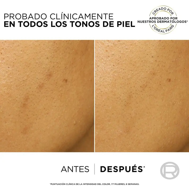 L'Oréal Paris Bright Reveal -kuorintavoide pigmenttimuutosten hoitoon