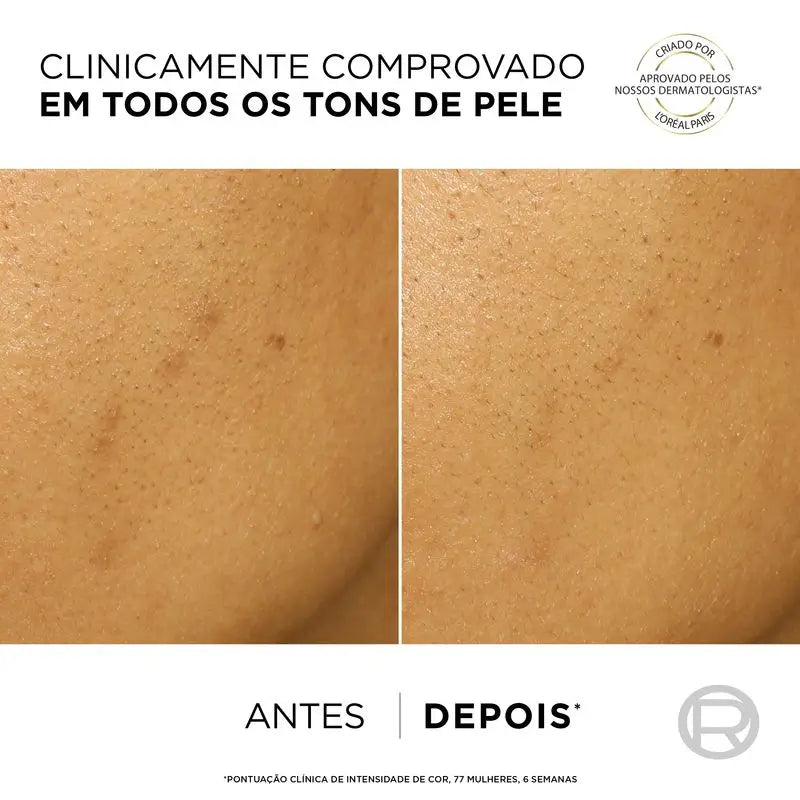 L'Oréal Paris Bright Reveal -kuorintavoide pigmenttimuutosten hoitoon