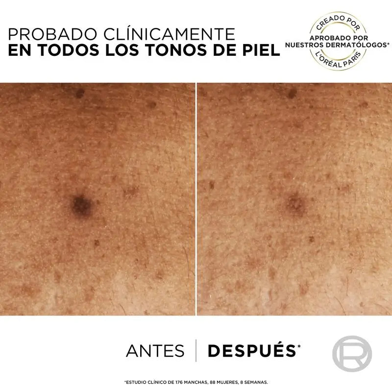 L'Oréal Paris Bright Reveal -seerumi, niacinamidi, pigmenttimuutoksia ehkäisevä