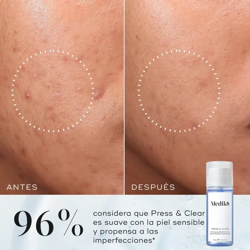 Medik8 Press & Clear, 150 ml