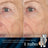 Medik8 Retinal Rewind: Crystal Retinal 3 30 ml + Crystal Retinal Ceramide 3 15 ml
