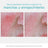 Neostrata Anti-Aging & Anti-Redness Serum, pigmenttimuutoksia torjuva seerumi, sisältää 6 % PHA:ta, 29 g
