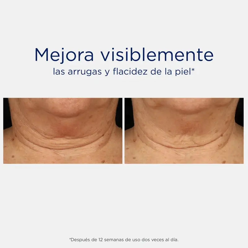 Neostrata Skin Active kaulan ja dekolteen kiinteyttävä voide, ryppyjä ehkäisevä voide 80 g