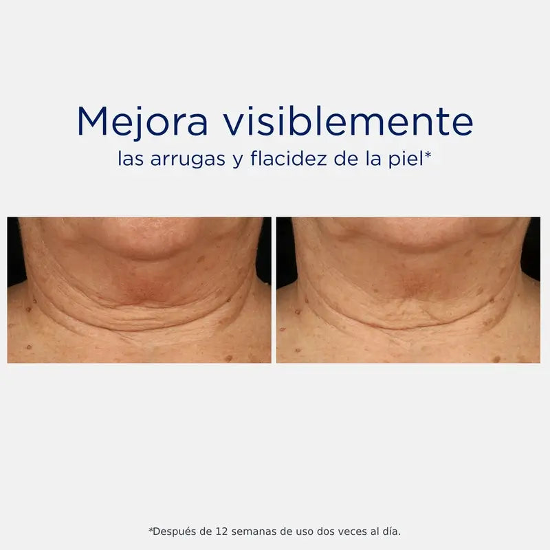 Neostrata Skin Active Tri-Therapy Lifting Serum, hyaluronihapposeerumi 30 ml