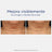 Neostrata Skin Active Tri-Therapy Lifting Serum, hyaluronihapposeerumi 30 ml