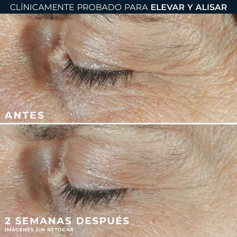 Roc Skincare Iberia Roc® Derm Correxion® Dual Eye 20 ml