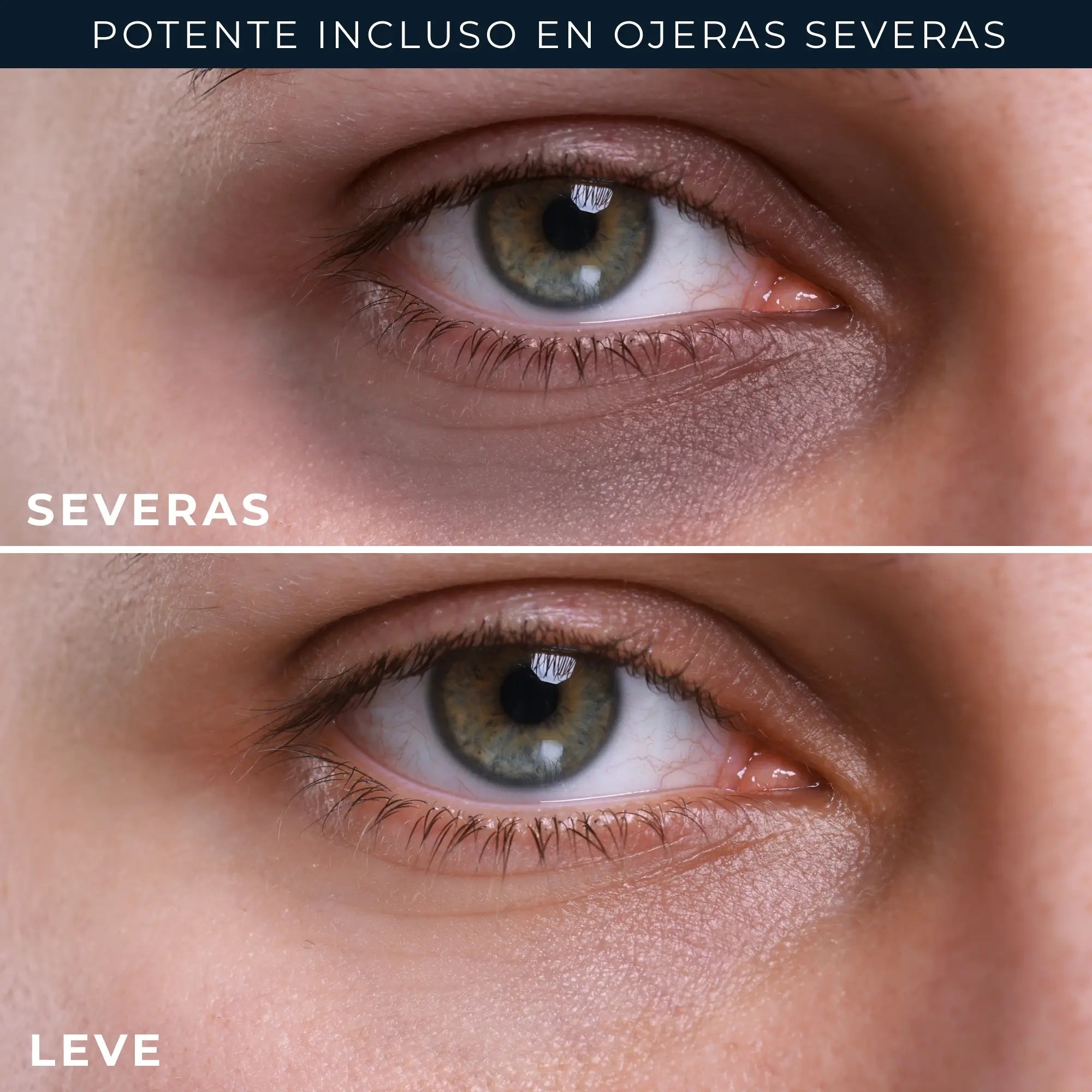 Roc Skincare Iberia Roc® Derm Correxion® Eye Repair 15 ml