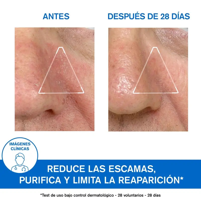 Uriage Ds Rauhoittava emulsio 40 ml, hajusteeton