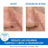 Uriage Ds Rauhoittava emulsio 40 ml, hajusteeton